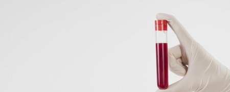 Кровь в пробирке
