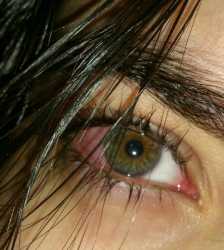 Заплаканные глаза девушки