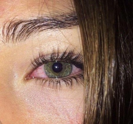 Заплаканные глаза девушки