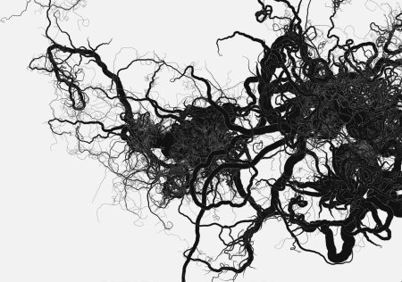 Черные сосуды