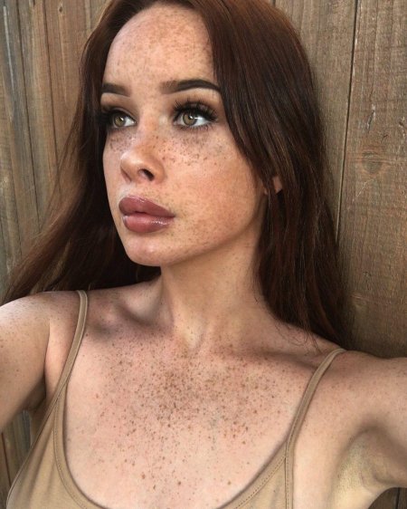 Селина Скиндер веснушки