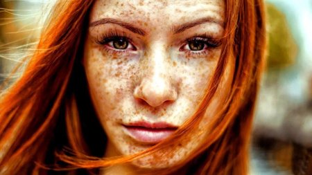 Селина Скиндер веснушки