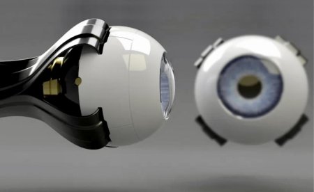 Сетчатки бионического глаза