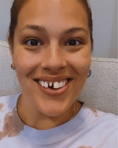 Эшли Грэм без зуба