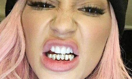 Грилзы Кайли Дженнер